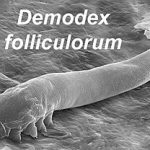 Demodex Mites: Linking Them to Chronic Dry Eye Issues