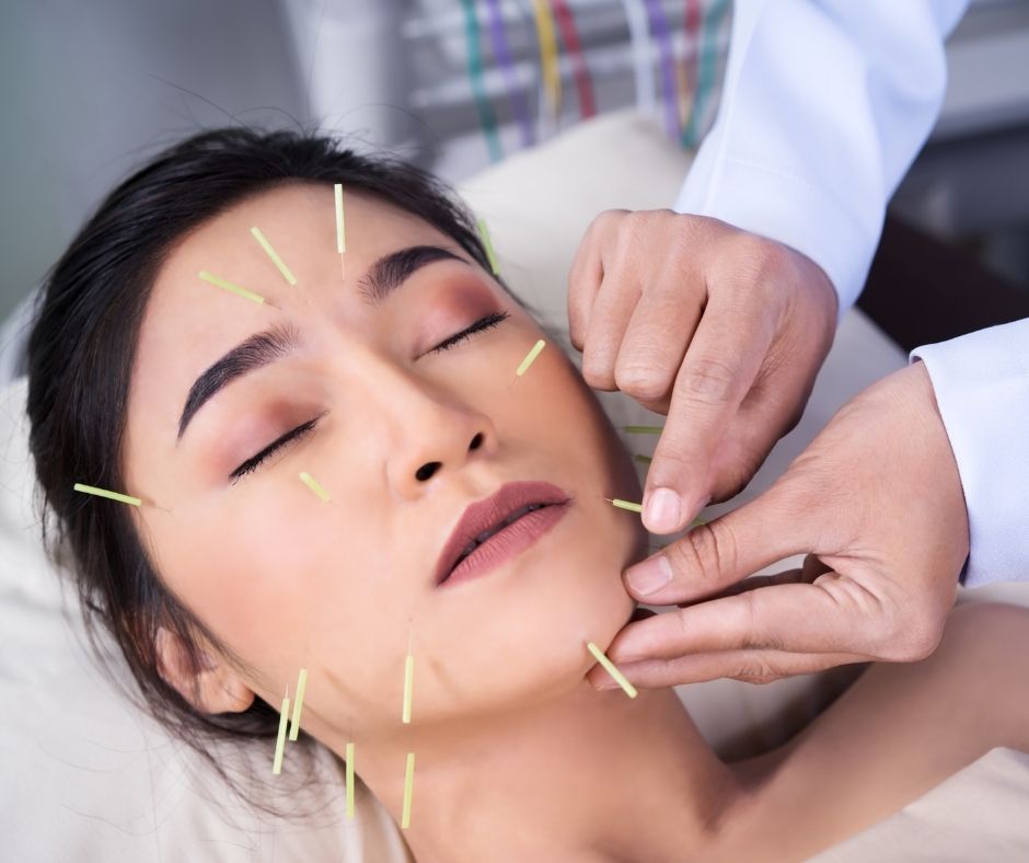 Cosmetic Acupuncture: Important Drawbacks to Know